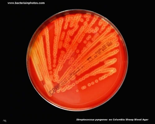 streptococcus on blood agar